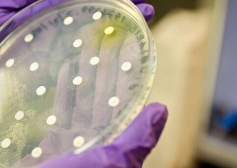 Bakterienkultur zur Diagnose von Prostatitis